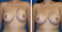 Before & After Photos